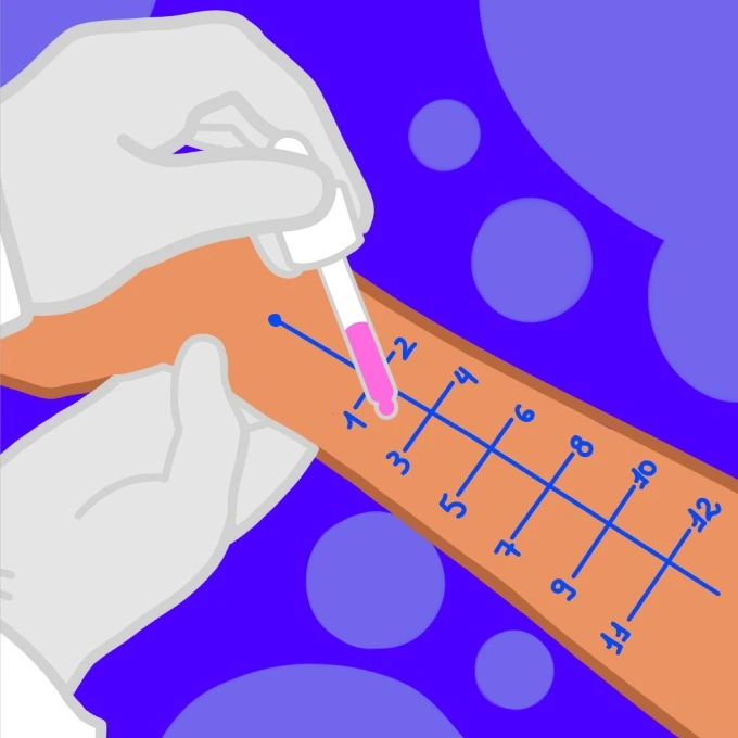 Alergista - Agilpass